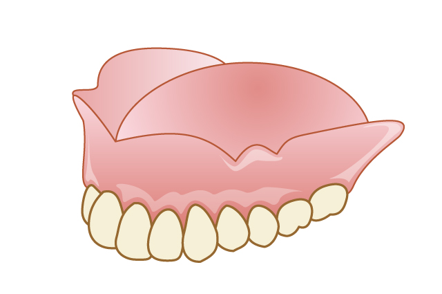 エムズ歯科コピオ外れない入れ歯フィットしていない入れ歯